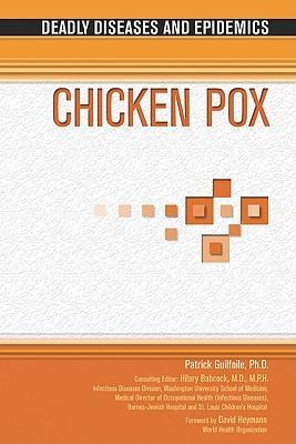 Chicken pox