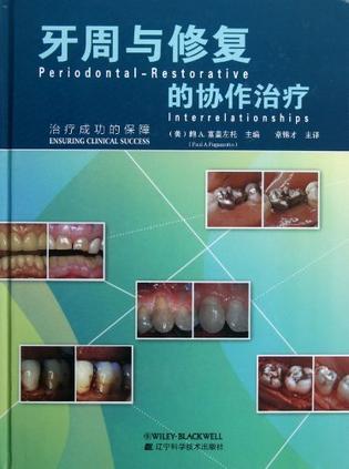 牙周与修复的协作治疗 治疗成功的保障 ensuring clinical success