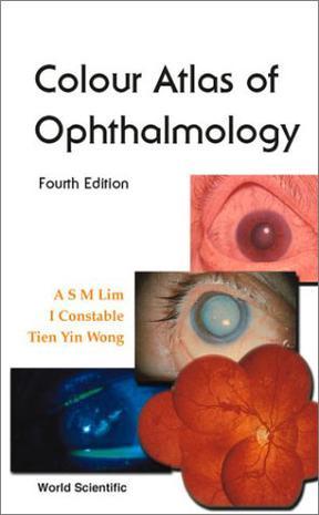 Colour atlas of ophthalmology