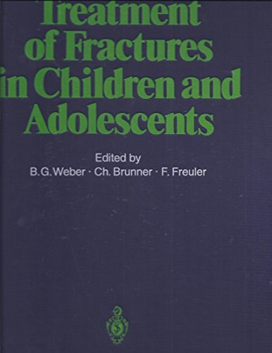 Treatment of fractures in children and adolescents