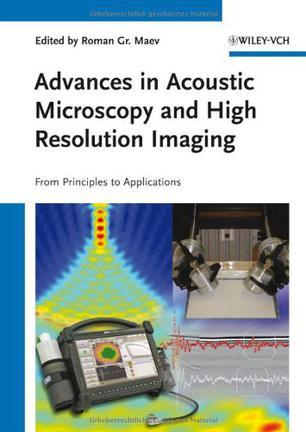 Advances in acoustic microscopy and high resolution imaging