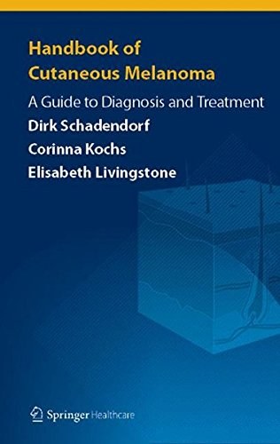 Handbook of cutaneous melanoma : a guide to diagnosis and treatment /