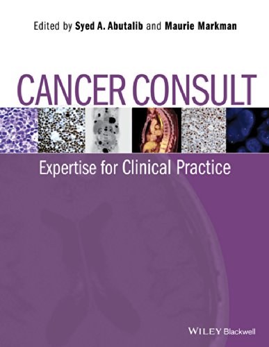 Cancer consult : expertise for clinical practice /