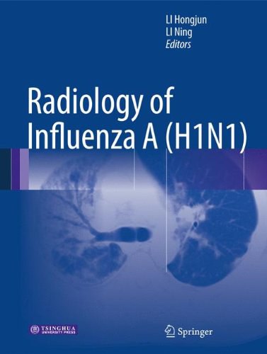 Radiology of influenza A (H1N1) /
