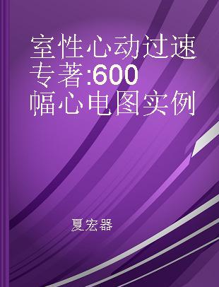 室性心动过速 600幅心电图实例