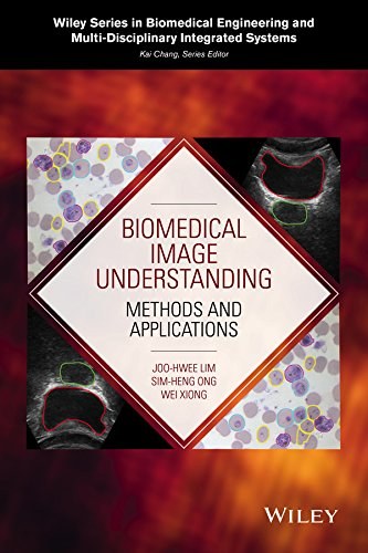 Biomedical image understanding : methods and applications /