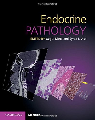 Endocrine pathology /