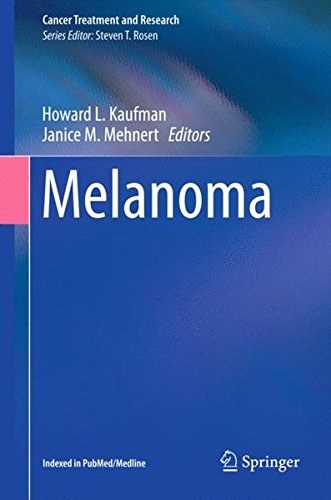 Melanoma /