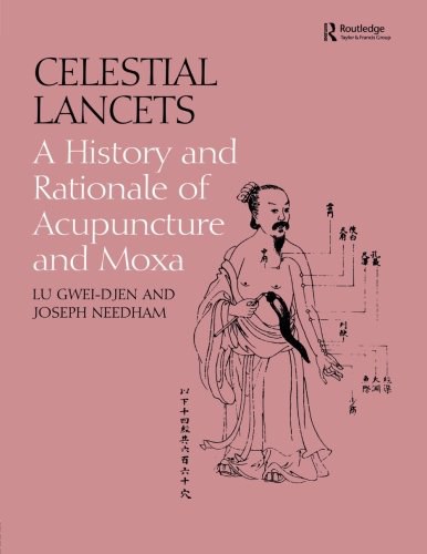 Celestial lancets : a history and rationale of acupuncture and moxa /
