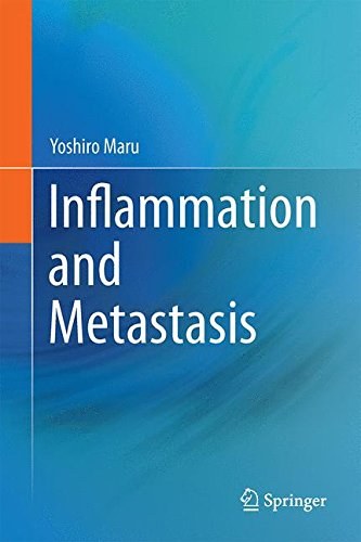 Inflammation and metastasis /