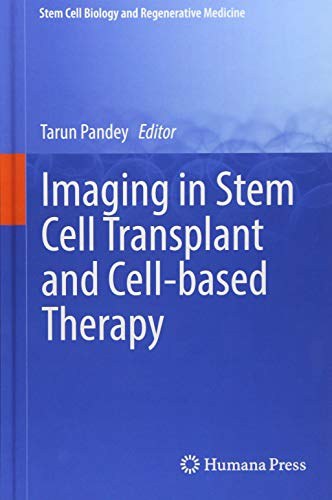 Imaging in stem cell transplant and cell-based therapy /