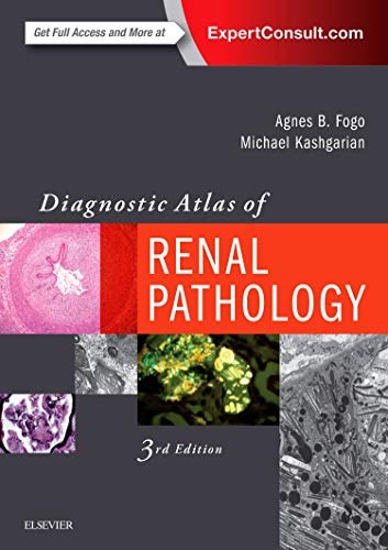 Diagnostic atlas of renal pathology /