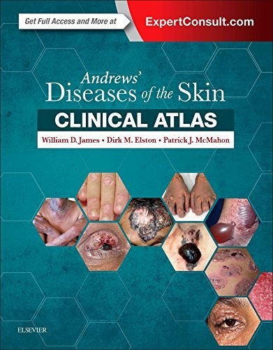Andrews' diseases of the skin : clinical atlas /
