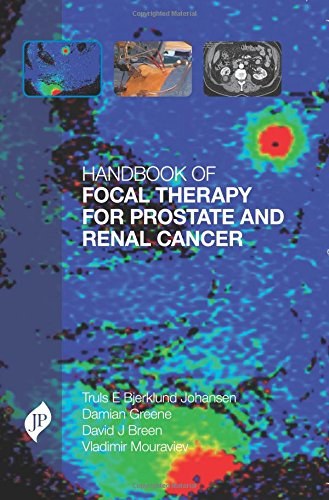 Handbook of focal therapy for prostate and renal cancer /