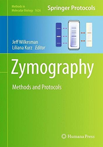 Zymography : methods and protocols /