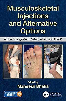 Musculoskeletal injections and alternative options : a practical guide to 'what, when and how?' /