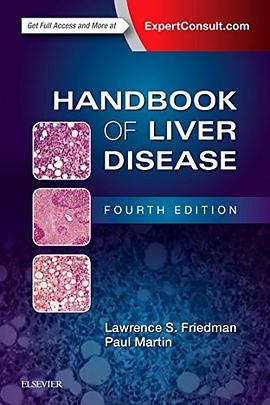 Handbook of liver disease /