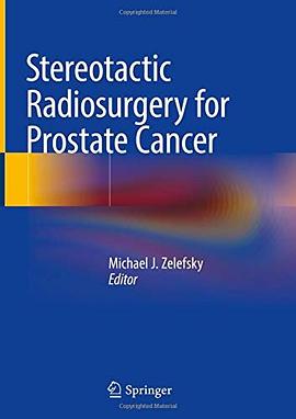 Stereotactic radiosurgery for prostate cancer /