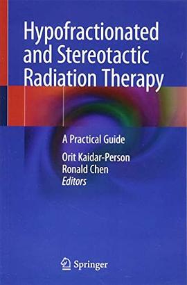 Hypofractionated and stereotactic radiation therapy : a practical guide /