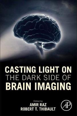 Casting light on the dark side of brain imaging /