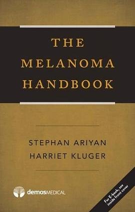 The melanoma handbook /