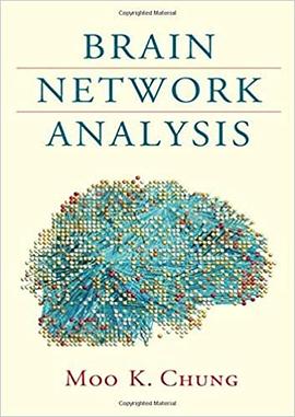 Brain network analysis /