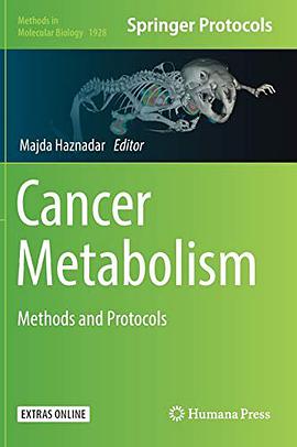 Cancer metabolism : methods and protocols /