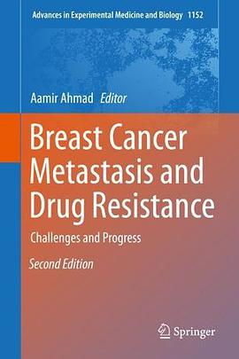 Breast cancer metastasis and drug resistance : challenges and progress /