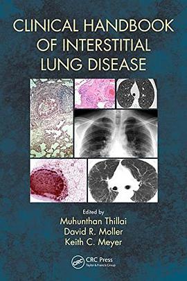 Clinical handbook of interstitial lung disease /
