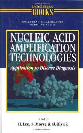 Nucleic acid amplification technologies application to disease diagnosis