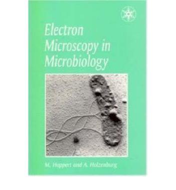 Electron microscopy in microbiology